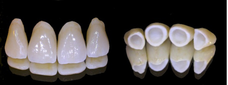 ceramica2_centrodenateleilsorriso-eu